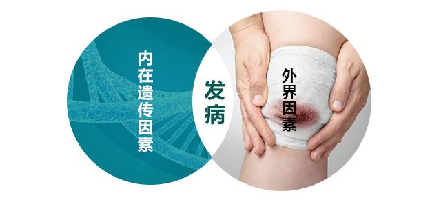 预防护理-得了白癜风要“忌口”吗？
